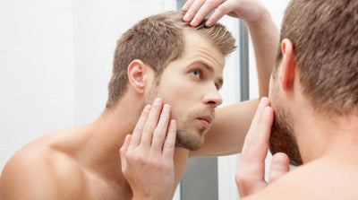 Men Open Up About The Emotional Toll Of Hair Loss Before Middle Age